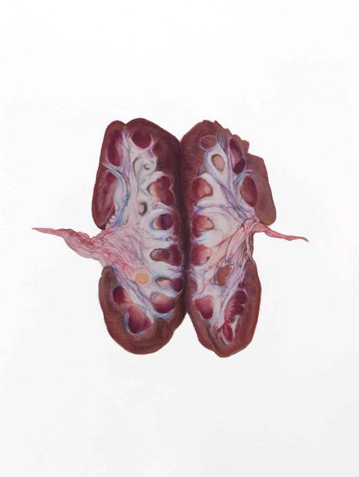 portfolio item Wilma Stegeman met de titel: Kidney